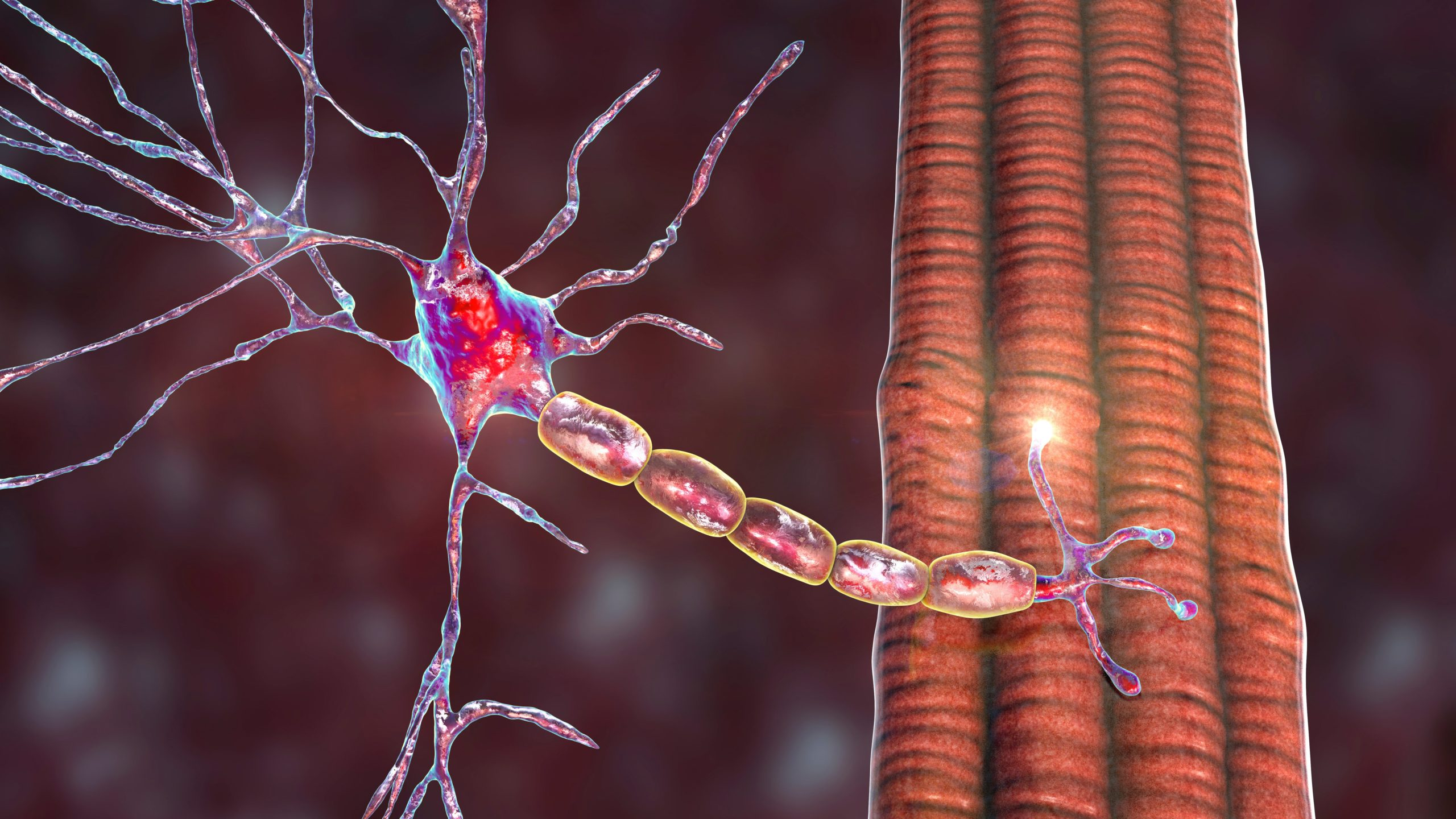 Myasthenia gravis