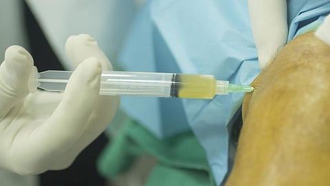 Platelet Rich Plasma therapy