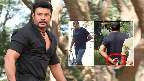Actor Darshan is in severe Back Pain
