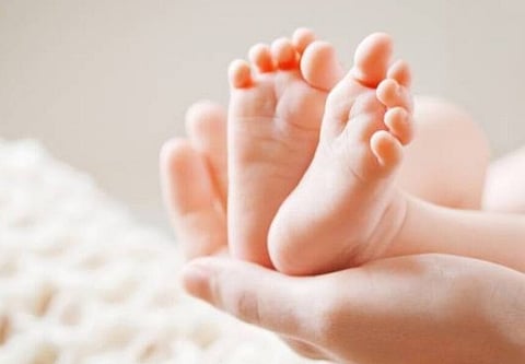 Representational image