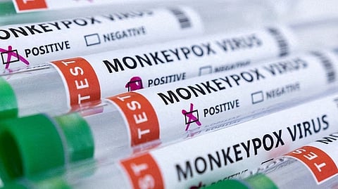 MonkeyPox