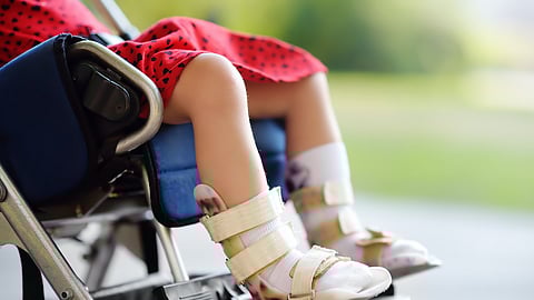 Cerebral palsy
