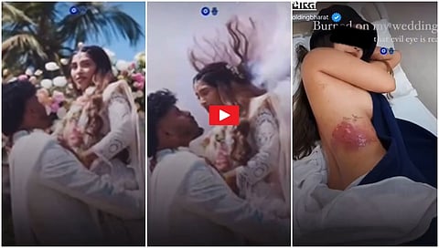 Wedding Photoshoot ಎಡವಟ್ಟು: ವಧುವಿಗೆ ಮರೆಯಲಾಗದ ದುಃಸ್ವಪ್ನ; ಆಗಿದ್ದೇನು? Video ನೋಡಿ!
