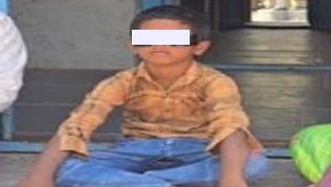 ದೃಷ್ಟಿ ಕಳೆದುಕೊಂಡ ಬಾಲಕ
