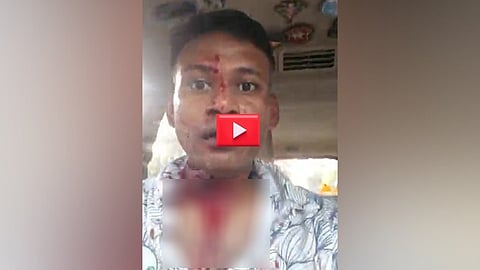 ಬೆಂಗಳೂರು: ಇದು ಕರ್ನಾಟಕನಾ? IAF ಅಧಿಕಾರಿ ಮೇಲೆ ಕನ್ನಡಿಗರಿಂದ ಹಲ್ಲೆ; ಕಿಡಿಕಾರಿದ ವಿಂಗ್ ಕಮಾಂಡರ್, Video!