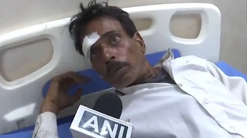 ಕುಲ್ಗಾಮ್ ನಲ್ಲಿ 3 ಬಸ್ ಗಳು ಡಿಕ್ಕಿ; 10 ಅಮರನಾಥ ಯಾತ್ರಿಕರಿಗೆ ಗಾಯ!