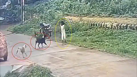 little girl in Karnataka is attacked by street dogs