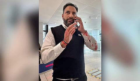 Delhi airport scuffle: AI Express issues notice to pilot