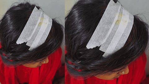 ಕಲ್ಲು ತೂರಾಟದಲ್ಲಿ ಗಾಯಗೊಂಡ ಮಾಲಾಧಾರಣಿ