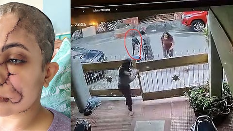 Woman attacked by dog