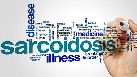 Sarcoidosis (image used for representational purpose only)