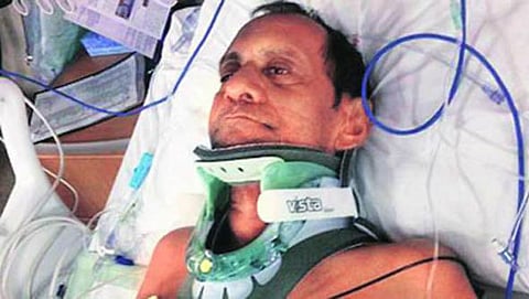 ಆಸ್ಪತ್ರೆಯಲ್ಲಿ ಚಿಕಿತ್ಸೆ ಪಡೆಯುತ್ತಿರುವ ಸುರೇಶ್ ಬಾಯಿ ಪಟೇಲ್ (ಚಿತ್ರ ಕೃಪೆ: al.com)