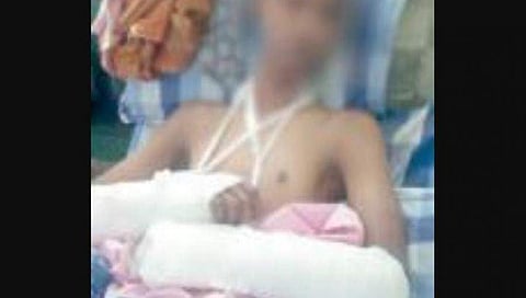 ಹಲ್ಲೆಗೊಳಗಾದ ಹುಡುಗ