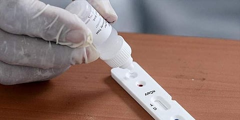 ಸಂಗ್ರಹ ಚಿತ್ರ