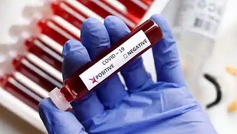 ಸಂಗ್ರಹ ಚಿತ್ರ