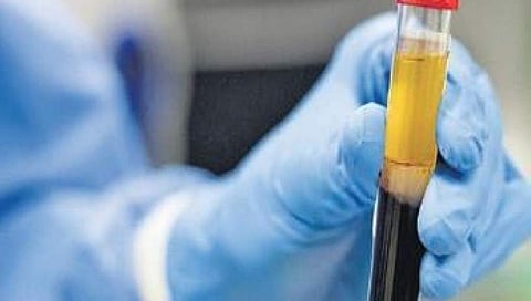 ಸಾಂದರ್ಭಿಕ ಚಿತ್ರ