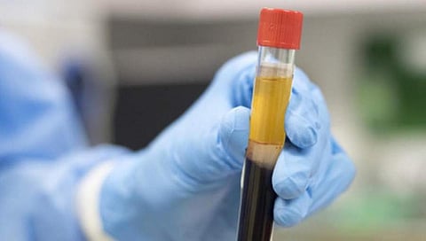 ಸಂಗ್ರಹ ಚಿತ್ರ