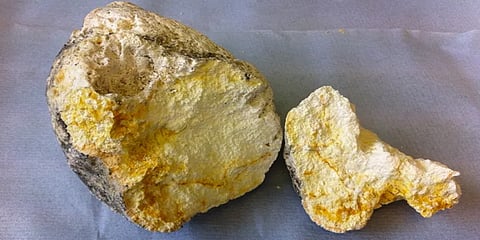 ಅಂಬರ್ಗ್ರಿಸ್