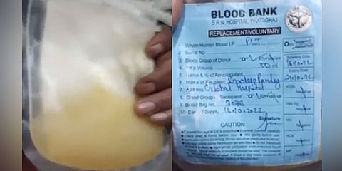ಪ್ಲಾಸ್ಮಾ ಪ್ಯಾಕೆಟ್ ನಲ್ಲಿ ಮೂಸಂಬಿ ರಸ