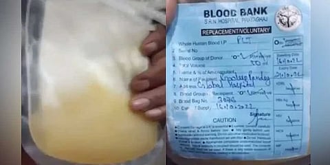 ಪ್ಲಾಸ್ಮಾ ಪ್ಯಾಕೆಟ್ ನಲ್ಲಿ ಮೂಸಂಬಿ ರಸ