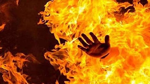 Representative Image