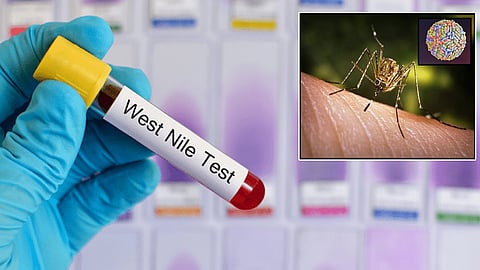 West Nile fever