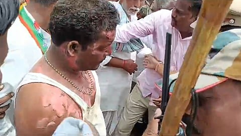 ಬೆಂಕಿ ಹಚ್ಚಿಕೊಳ್ಳಲು ಯತ್ನಿಸಿ ಗಾಯಗೊಂಡ ದ್ಯಾವಪ್ಪ ಮಾಗಿ