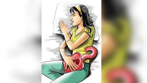 Representative Image