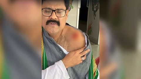 Assam congress leader 