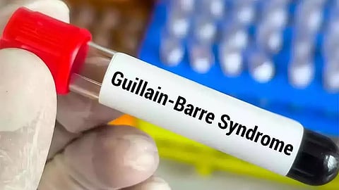 GBS Syndrome 