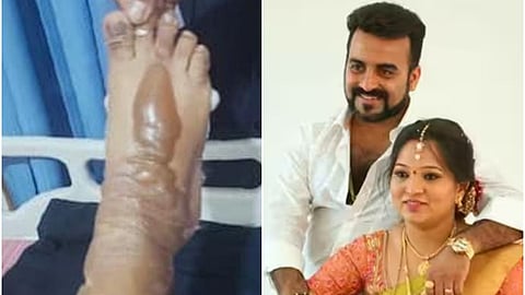 ಯಶಸ್ವಿನಿಯವರು ಗಾಯಗೊಂಡಿರುವುದು.