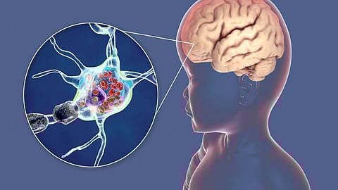Lysosomal Storage Disorders