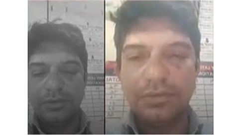 ಬೆಂಗಳೂರು: ರಸ್ತೆಯಲ್ಲಿ ಕಸ ಹಾಕಬೇಡಿ ಅಂದಿದ್ದಕ್ಕೆ ಪ್ರಾಧ್ಯಾಪಕನಿಗೆ ಹಿಗ್ಗಾಮುಗ್ಗ ಥಳಿತ; ಪ್ರಕರಣ ದಾಖಲು!