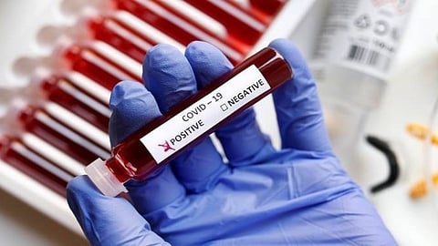 covid-19 cases