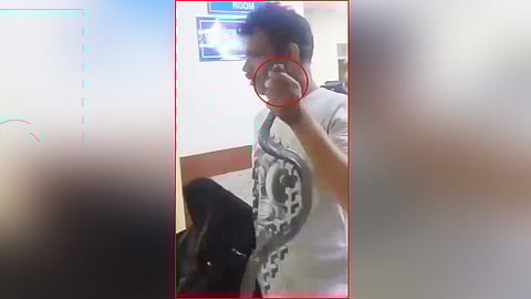 Rajasthan Man Walks Into Hospital Holding Huge Snake