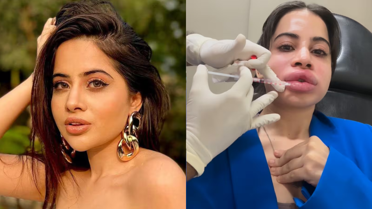 Bollywood Actress Uorfi Javed gets her lip fillers dissolved