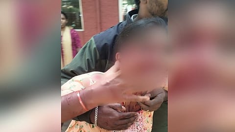 The victim, Gangubai, being rescued after a stray dog attacked her