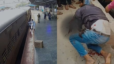  young man's hand was cut 