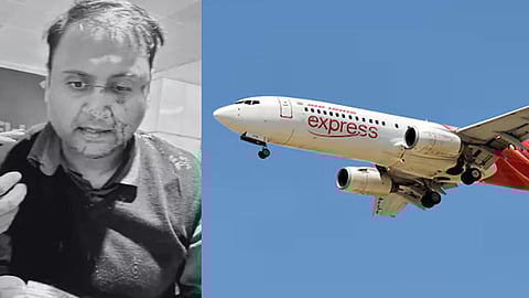 The passenger, Ankit Dewan, posted on X a photo with blood on his face
