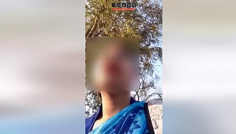 Tripura woman alleges sexual harassment by 'completely naked' man in Bengaluru; case registered