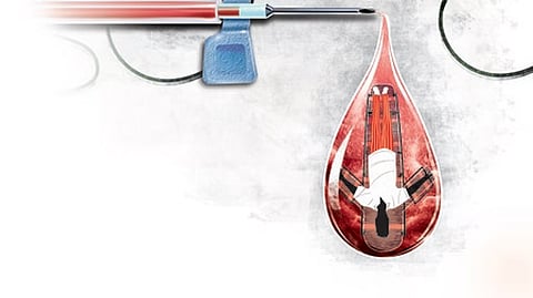 Representational image 