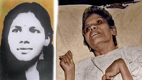 ಅರುಣಾ ಶಾನಭಾಗ್