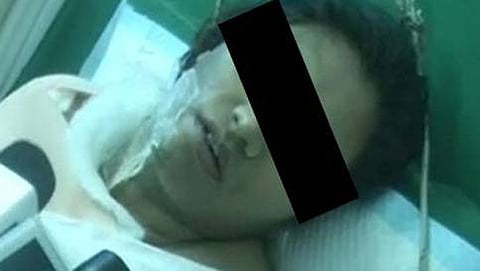 ಆಸಿಡ್ ದಾಳಿಗೆ ಒಳಗಾದ ಸಂತ್ರಸ್ತೆ
