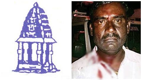 ಹಲ್ಲೆಗೊಳಗಾಗಿರುವ ಪೀಣ್ಯ ಕೈಗಾರಿಕಾ ಪ್ರದೇಶದ ಜೆಡಿಎಸ್ ಅಭ್ಯರ್ಥಿ ಸಂಬಂಧಿ ಗೋಪಾಲ್.