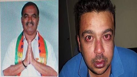 ಬಿಬಿಎಂಪಿ ಕಾರ್ಪೊರೇಟರ್ ಗುರುಮೂರ್ತಿ ರೆಡ್ಡಿ ಹಾಗೂ ಹಲ್ಲೆಗೊಳಗಾದ ವ್ಯಕ್ತಿ