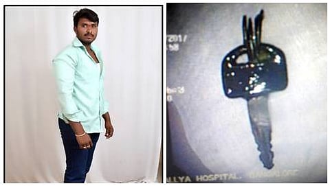 ಬೈಕ್ ಕೀ ನುಂಗಿದ್ದ ಸಬಾ ರೆಡ್ಡಿ
