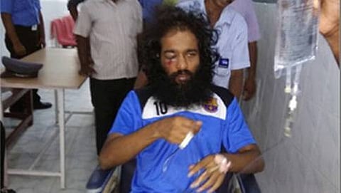 ಹಲ್ಲೆಗೊಳಗಾದ ವಿದ್ಯಾರ್ಥಿ