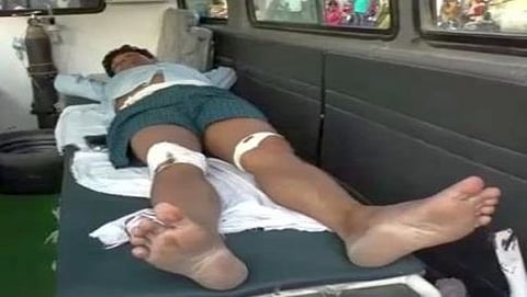 ಗಾಯಗೊಂಡು ಆಸ್ಪತ್ರೆ ಸೇರಿರುವ ಪ್ರೊಫೆಸರ್