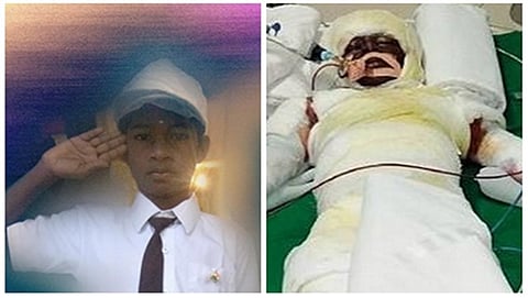 ಗಾಯಾಳು ಬಾಲಕ ಪ್ರವೀಣ್
