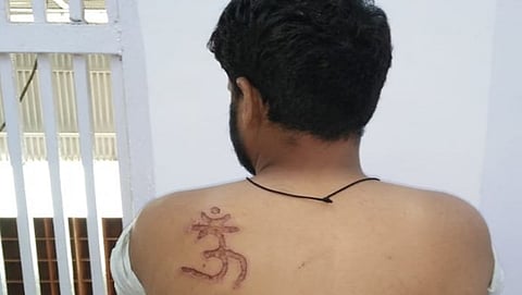 ಕೈದಿಗೆ "ಓಂ' ಚಿಹ್ನೆಯ ಬರೆ: ತನಿಖೆಗೆ ದೆಹಲಿ ನ್ಯಾಯಾಲಯ ಆದೇಶ